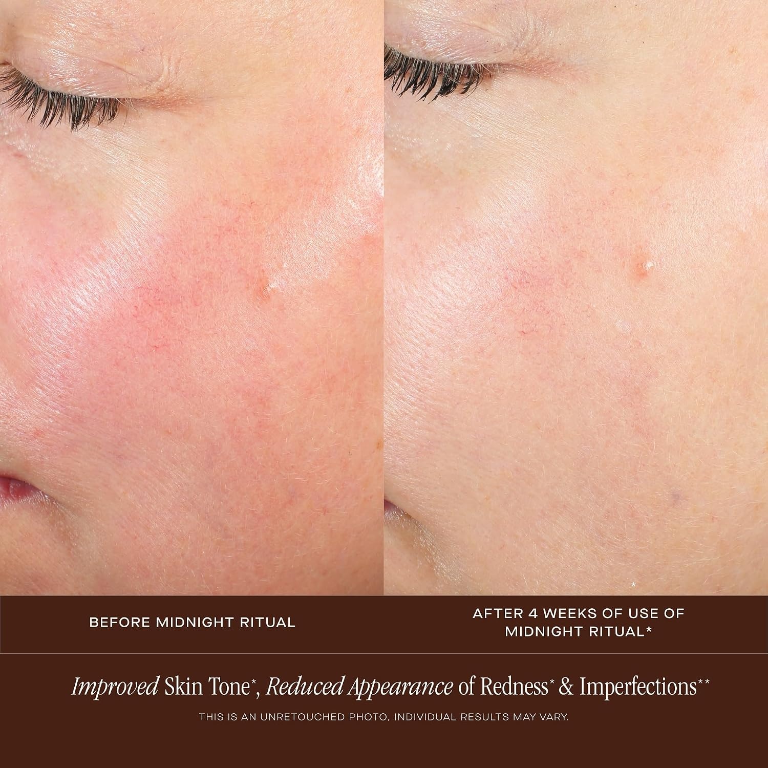 image:imageSummer Fridays Midnight Ritual Retinol Serum Renewal Anti Aging Serum for Face Fine Lines amp Discoloration Enriched with Jojoba Oil Hyaluronic Acid amp Niacinamide to Renew Skins Appearance 1 oz
